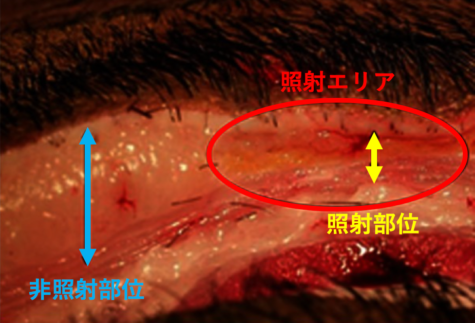 照射部位と非照射部位