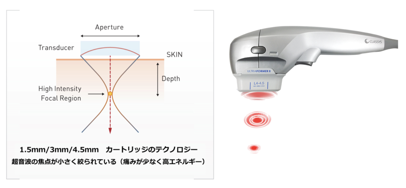 9D hifu カートリッジ 4.5 pa-kotabumi.go.id