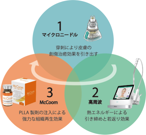 ポテンツァの持つ３つの特徴の説明